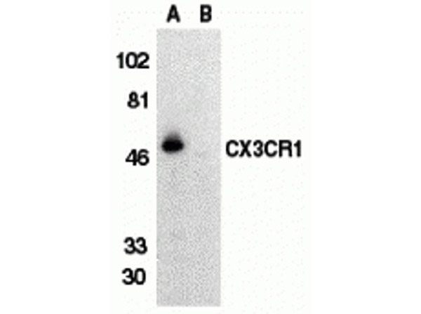 Western blot of CX3CR1