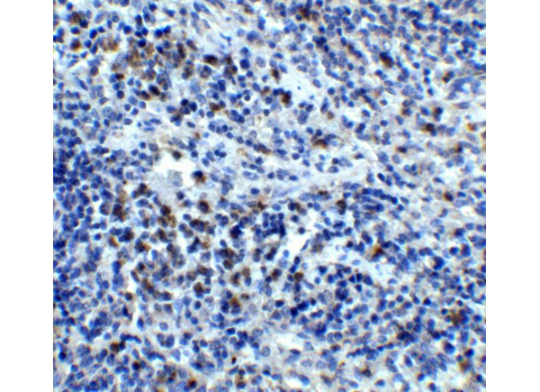 Immunohistochemistry Validation of CXCR4