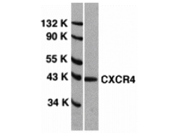 Western Blot Validation of CXCR4