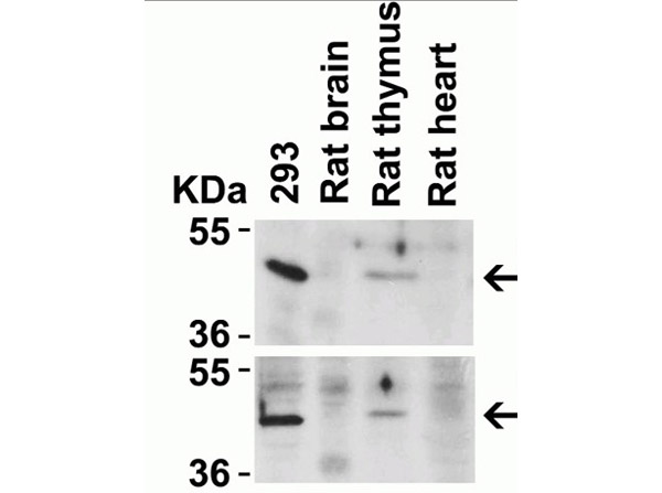 Western Blot Validation of CXCR4