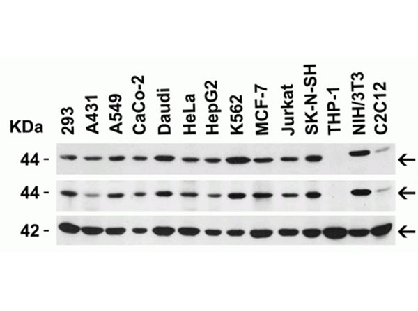 Western Blot of CXCR4