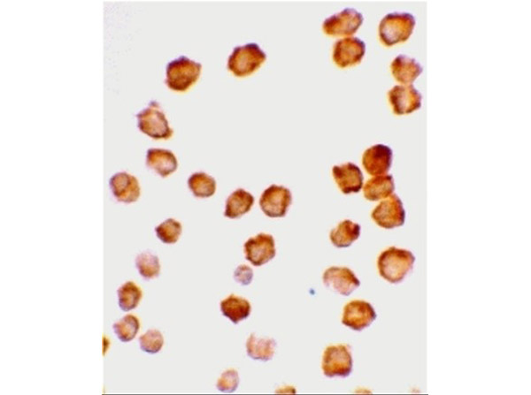 Immunocytochemistry of Anti-DcR2