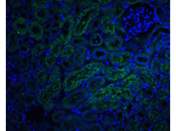 Immunofluorescence of Anti-DcR2