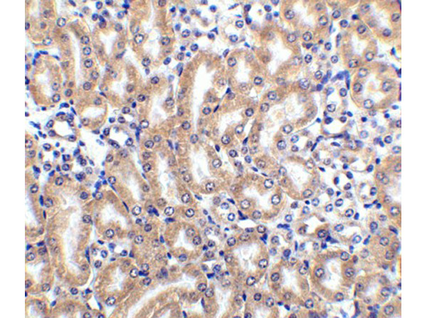 Immunohistochemistry of Anti-DcR2