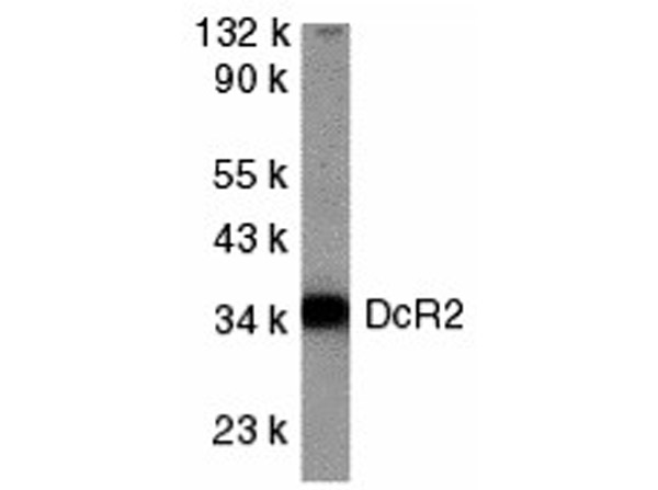 Western blot analysis of DcR2