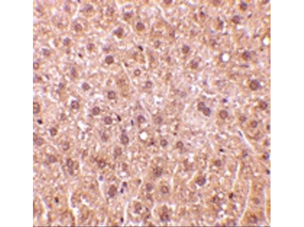 Immunohistochemistry of DEDAF