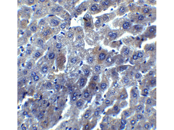 Immunohistochemistry of DEDAF