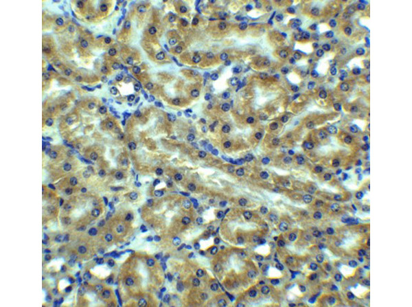 Immunohistochemistry of Anti-DR5