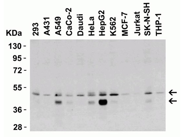 Western Blot Validation of Anti-DR5