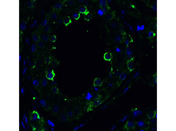 Immunofluorescence of Anti-DR5