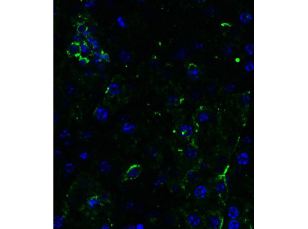 Immunofluorescence of Anti-DR5