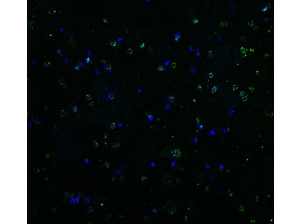 Immunofluorescence of Anti-DR5