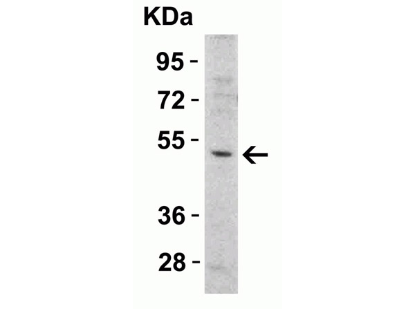 Western Blot Validation of Anti-DR5