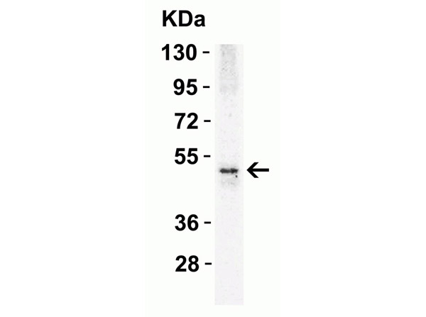 Western Blot Validation of Anti-DR5