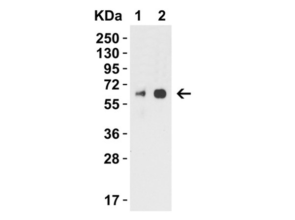 Western Blot of Anti-H1N1 Neuraminidase