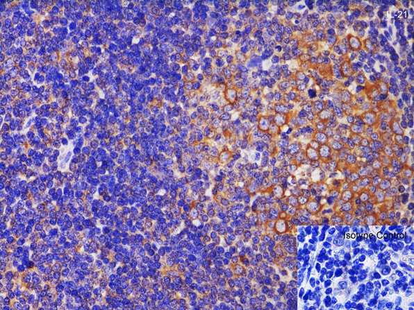 Immunohistochemistry using Anti-IL-21