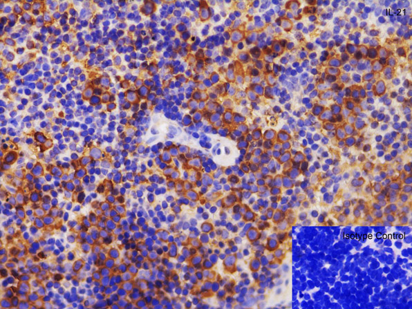 Immunohistochemistry using Anti-IL-21