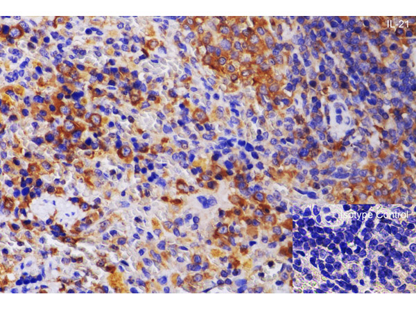 Immunohistochemistry using Anti-IL-21