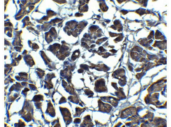 Immunohistochemistry of IL-23