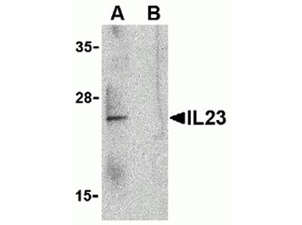 Western Blot of IL-23