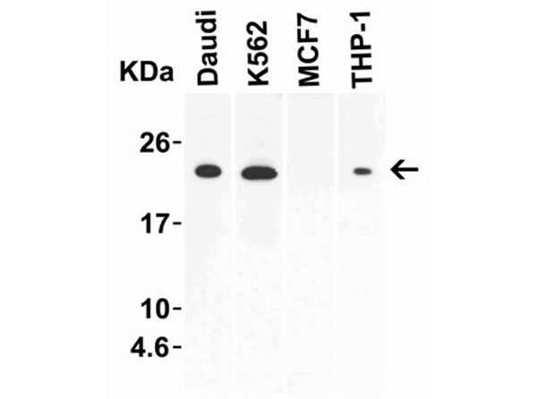 Western Blot of IL-23