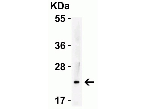 Western Blot of IL-23