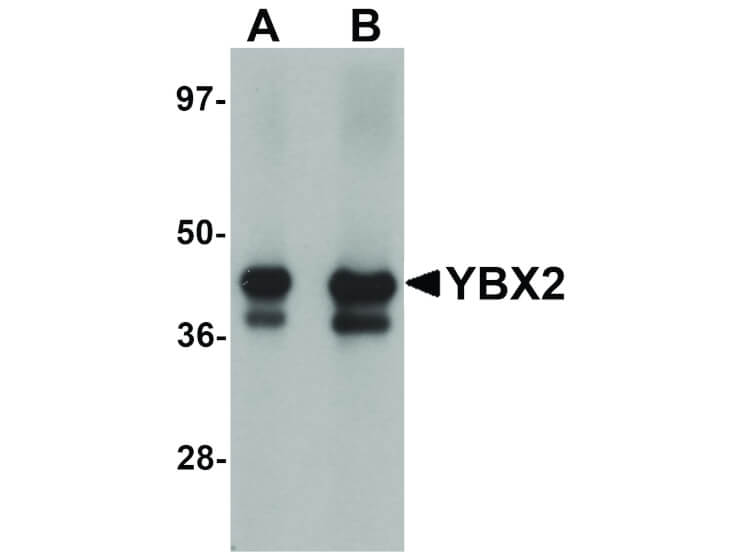 Western Blot of  YBX2 antibody