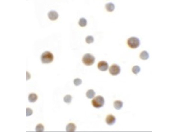 Immunocytochemistry of YPEL1