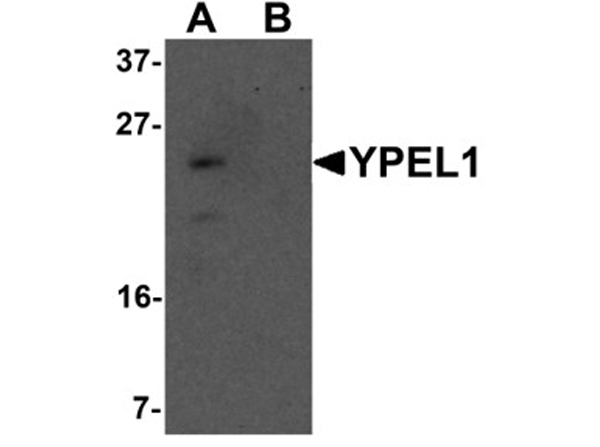 Western blot analysis of YPEL1