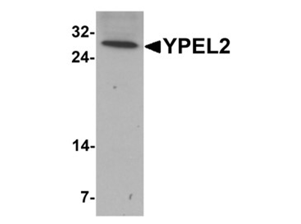 Western blot analysis of YPEL2