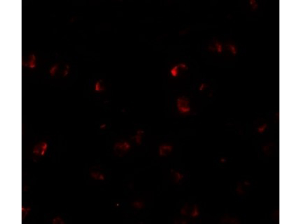Immunofluorescence of YPEL3