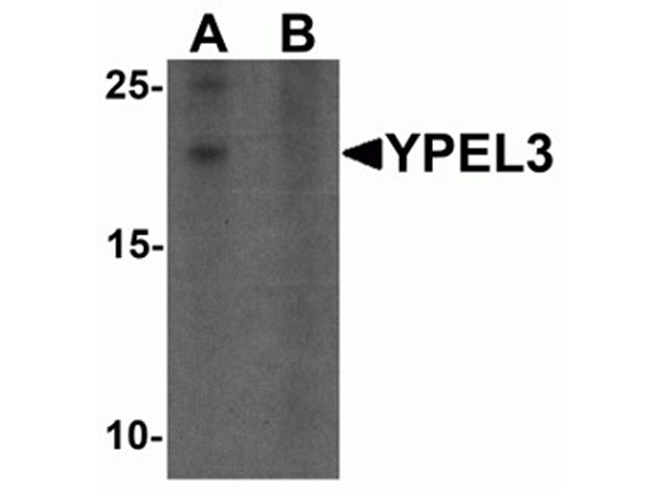 Western blot analysis of YPEL3