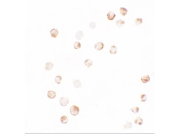Immunocytochemistry of YPEL4