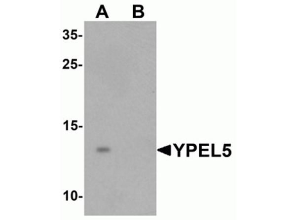 Western blot analysis of YPEL5