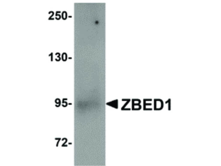 Western Blot of ZBED1 Antibody