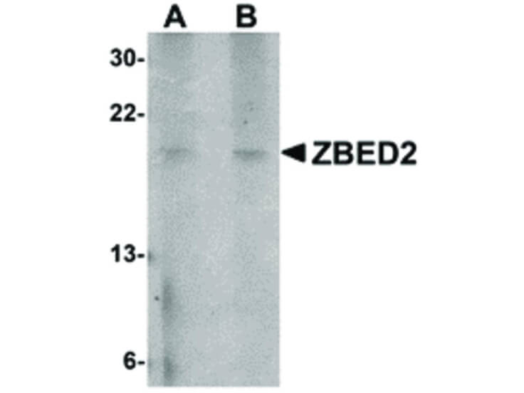 Western Blot of ZBED2 Antibody