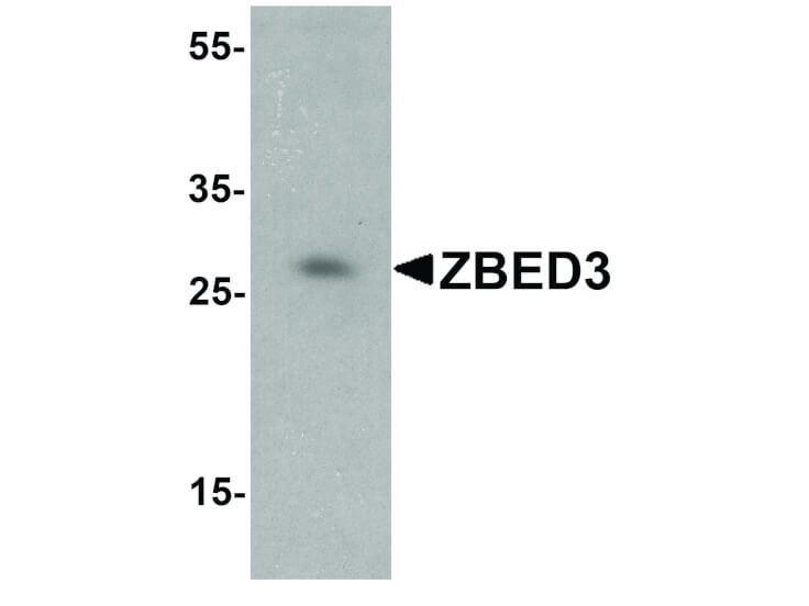 Western Blot of ZBED3 Antibody