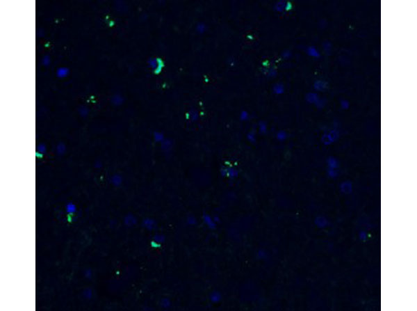 Immunofluorescence of ZBP1