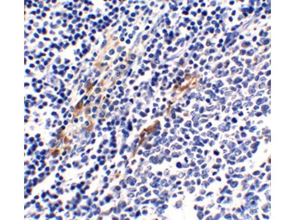 Immunohistochemistry of ZBP-1