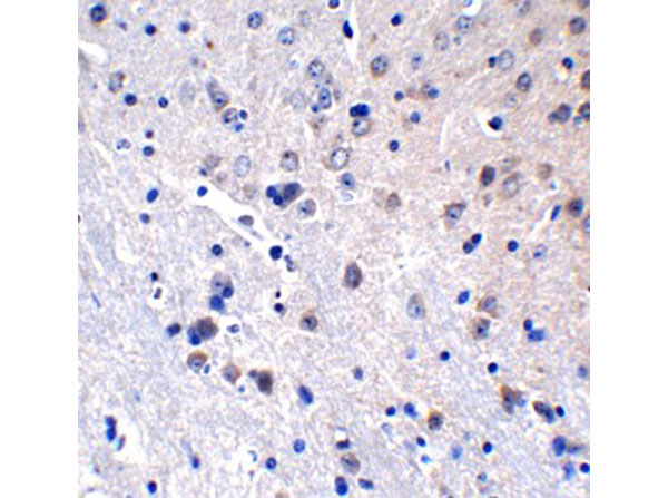 Immunohistochemistry of ZBP-1