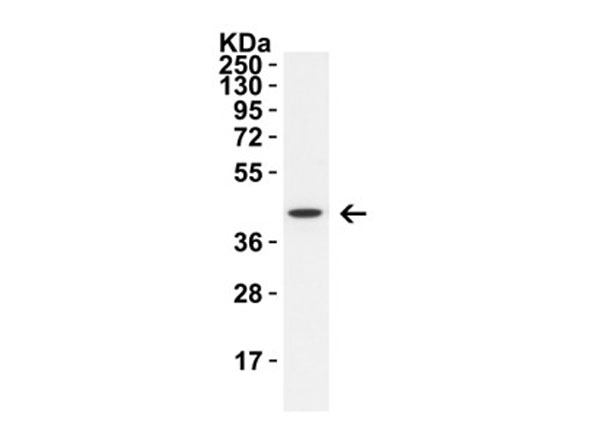 Western Blot of ZBP1.