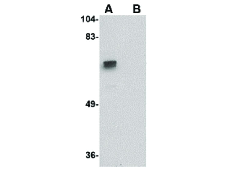 Western Blot of ZBRK1 Antibody