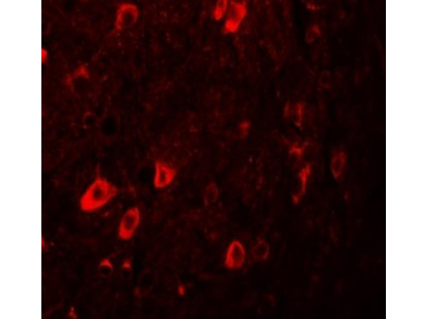 Immunofluorescence of ZBTB3