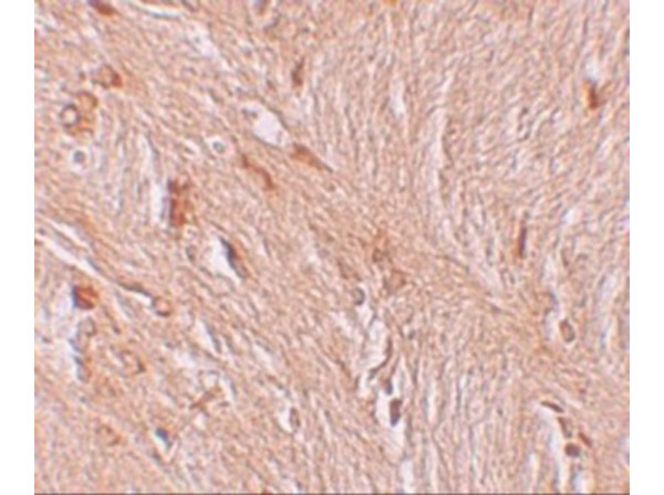 Immunohistochemistry of ZBTB3