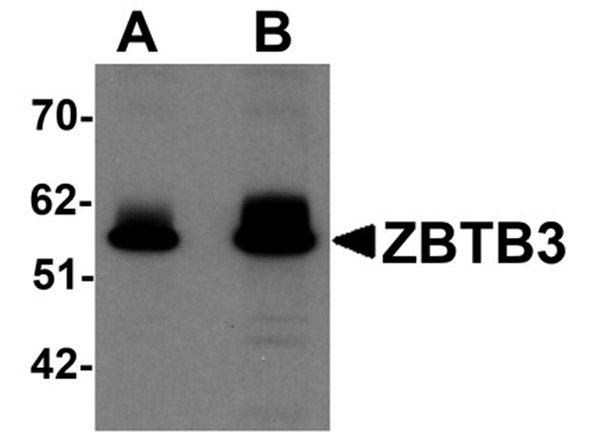 Western blot analysis of ZBTB3