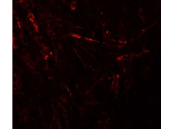 Immunofluorescence of ZBTB4