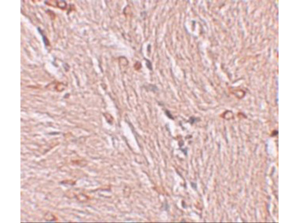 Immunohistochemistry of ZBTB4