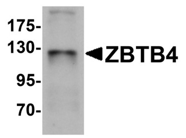 Western blot analysis of ZBTB4