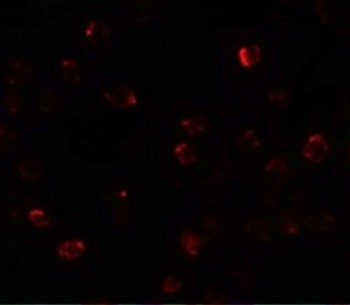 Immunofluorescence of ZBTB40