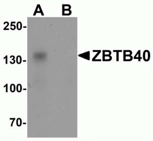 Western blot analysis of ZBTB40